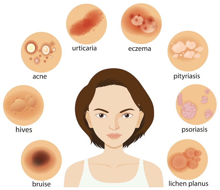 types of skin diseases